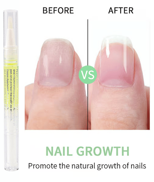 Cosmetics Nail Growth Oil