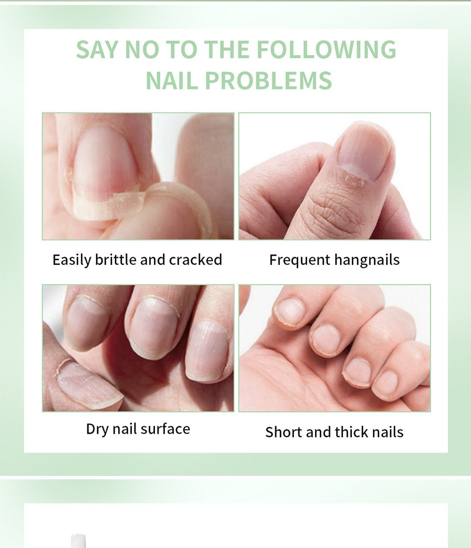 Cosmetics Nail Growth Oil
