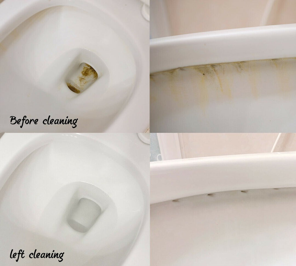 2023 New Year Sale🔥Buy 2 Get 1 Free🔥 Powerful stain removal kit